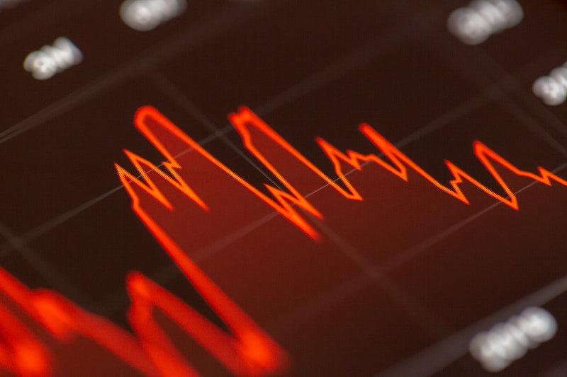 Strategy паузить BTC, запускає buyback на $1 млрд